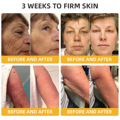 💐🐝LOVILDS™ BeeLift Anti-Aging Firming Cream,Address Crepe & Sagging(🔥74% Off for a Limited Time!)（副本）