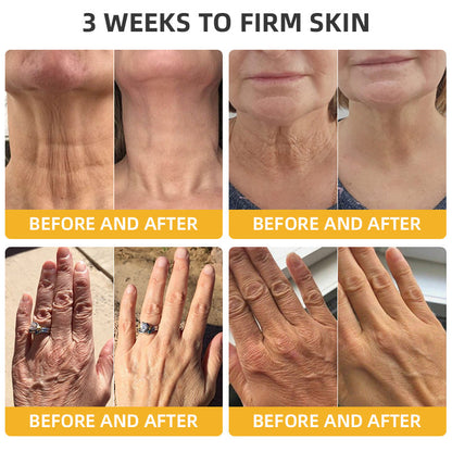 💐🐝LOVILDS™ BeeLift Anti-Aging Firming Cream,Address Crepe & Sagging(🔥74% Off for a Limited Time!)（副本）