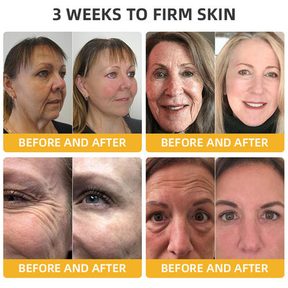 💐🐝LOVILDS™ BeeLift Anti-Aging Firming Cream,Address Crepe & Sagging(🔥74% Off for a Limited Time!)（副本）