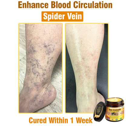 LOVILDS™ Bee Poison All-in-One Cream US Dermatologist Approved（副本）