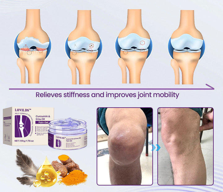 LOVILDS™ Curcumin & Emu Oil Pain Gel – 🏥Backed by US Osteopathic Experts（副本）